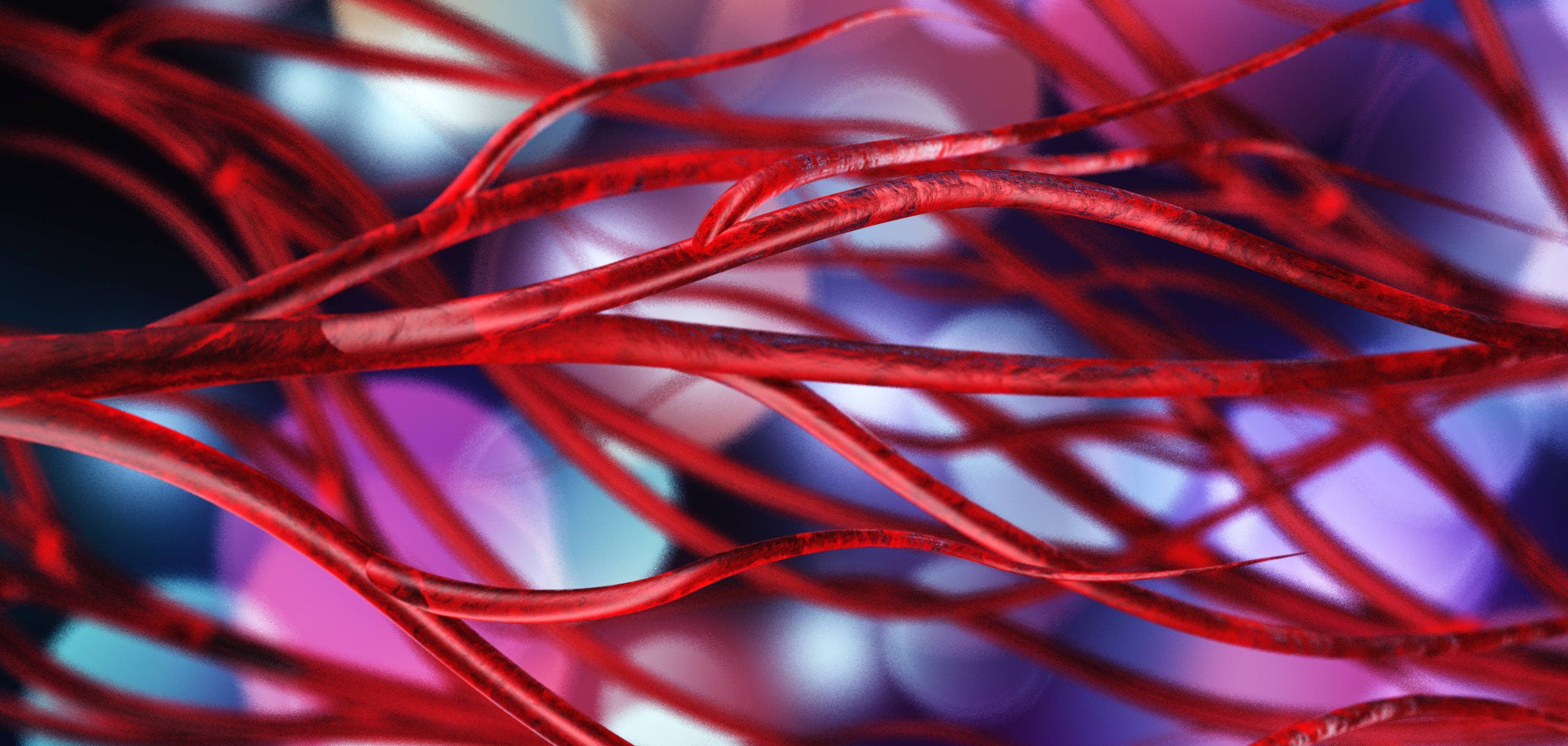 Circulatory Problems: Taking Care of Veins and Arteries.