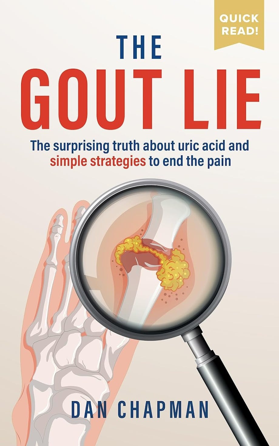 The Gout Lie, a book by Dan Chapman
